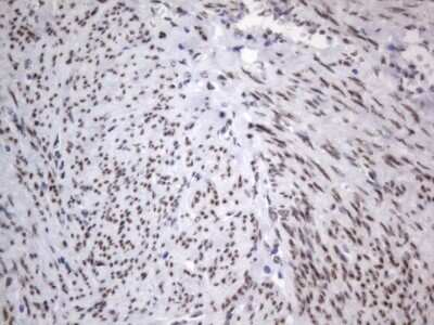 Immunohistochemistry: A2BP1 Antibody (OTI4F9) [NBP2-45532]