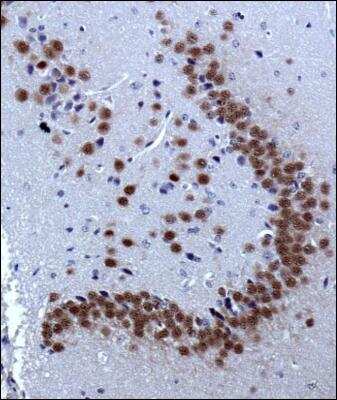 Immunohistochemistry: A2BP1 Antibody (D8H8) [NBP2-13169]