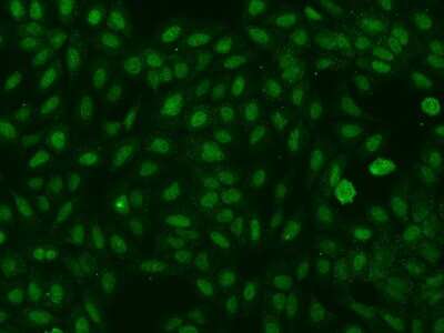 Immunocytochemistry/ Immunofluorescence: A2BP1 Antibody [NBP2-98015]