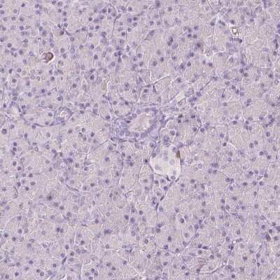Immunohistochemistry-Paraffin: A2BP1 Antibody [NBP1-90304]