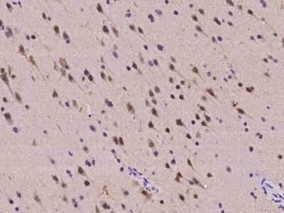 Immunohistochemistry-Paraffin: A2BP1 Antibody [NBP2-98015]