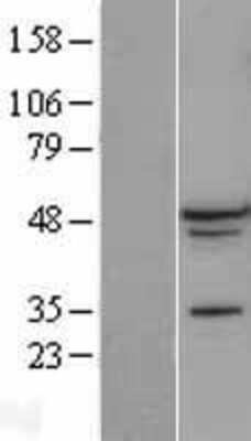 Western Blot: A2BP1 Overexpression Lysate [NBL1-07156]