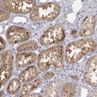Immunohistochemistry-Paraffin: A2LD1 Antibody [NBP2-38064]