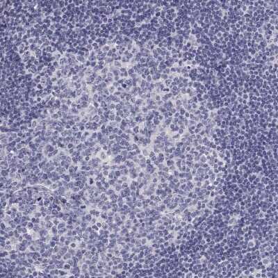 Immunohistochemistry-Paraffin: A2LD1 Antibody [NBP2-38064]