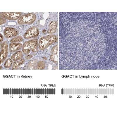 Immunohistochemistry-Paraffin: A2LD1 Antibody [NBP2-38064]
