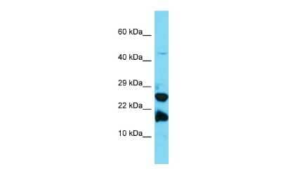 Western Blot: A2LD1 Antibody [NBP2-82542]