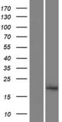 Western Blot: A2LD1 Overexpression Lysate [NBP2-09941]