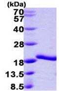 SDS-PAGE: Recombinant Human A2LD1 His Protein [NBP1-78799]