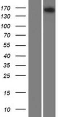 Western Blot: alpha 2-Macroglobulin-like 1/A2ML1 Overexpression Lysate [NBP2-05544]