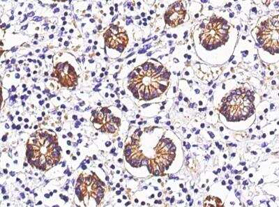 Immunohistochemistry-Paraffin: A33/GPA33 Antibody (071) [NBP2-89873]