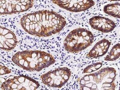 Immunohistochemistry-Paraffin: A33/GPA33 Antibody (071) [NBP2-89873]