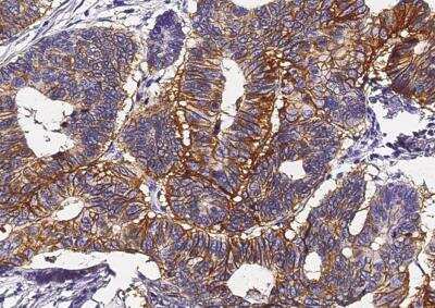 Immunohistochemistry-Paraffin: A33/GPA33 Antibody (071) [NBP2-89873]