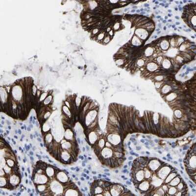 Immunohistochemistry-Paraffin: A33/GPA33 Antibody [NBP1-89332]
