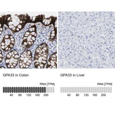 Immunohistochemistry-Paraffin: A33/GPA33 Antibody [NBP1-89332]