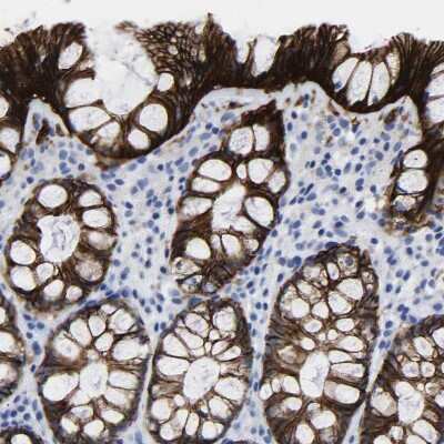 Immunohistochemistry-Paraffin: A33/GPA33 Antibody [NBP1-89332]