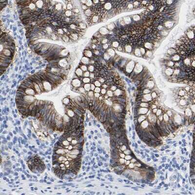 Immunohistochemistry-Paraffin: A33/GPA33 Antibody [NBP1-89332]
