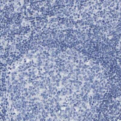 Immunohistochemistry-Paraffin: A33/GPA33 Antibody [NBP1-89332]