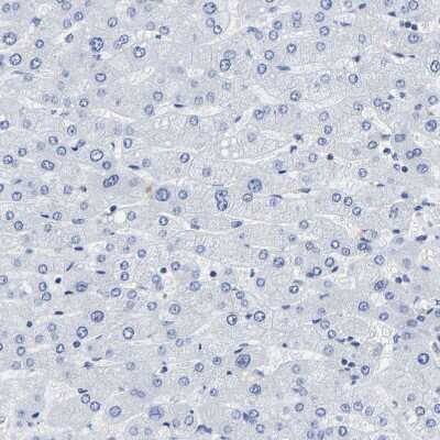 Immunohistochemistry-Paraffin: A33/GPA33 Antibody [NBP1-89332]