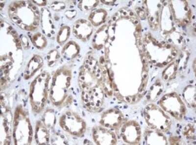 Immunohistochemistry: A4GNT Antibody (OTI2H9) [NBP2-45539]