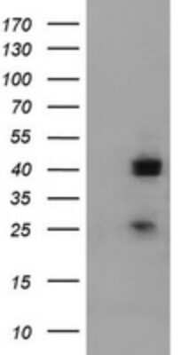 Western Blot: A4GNT Antibody (OTI2H9) [NBP2-45539]