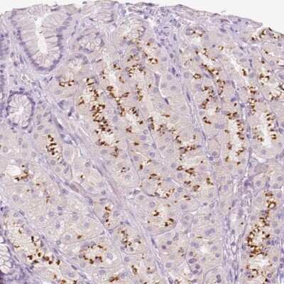 Immunohistochemistry-Paraffin: A4GNT Antibody [NBP1-89129]