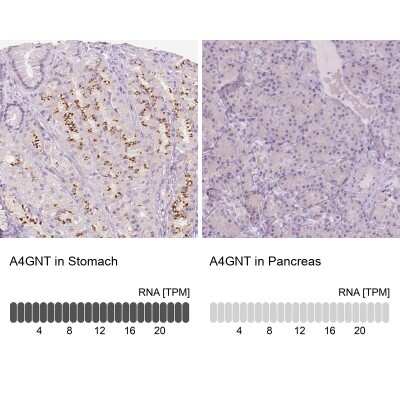 Immunohistochemistry-Paraffin: A4GNT Antibody [NBP1-89129]