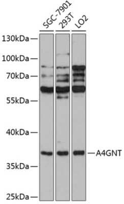 Western Blot: A4GNT AntibodyAzide and BSA Free [NBP2-92076]