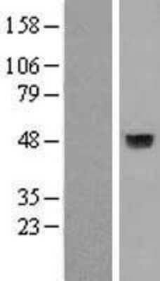 Western Blot: A4GNT Overexpression Lysate [NBP2-07080]