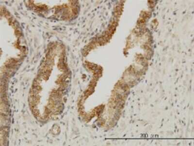 Immunohistochemistry-Paraffin: AAAS Antibody (5A1) [H00008086-M02]