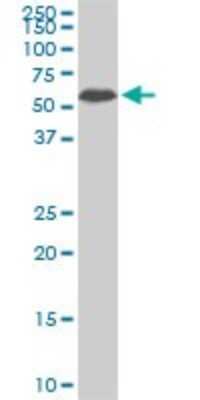 Western Blot: AAAS Antibody (5A1) [H00008086-M02]