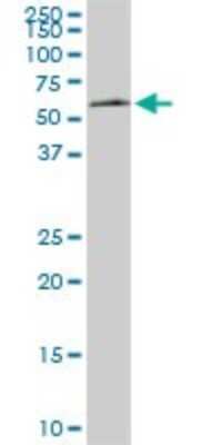 Western Blot: AAAS Antibody (5A1) [H00008086-M02]