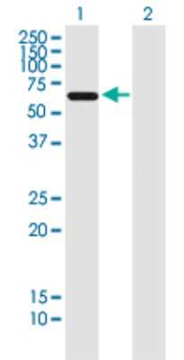 Western Blot: AAAS Antibody (5A1) [H00008086-M02]