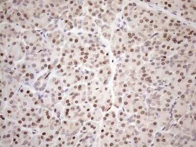 Immunohistochemistry: AAAS Antibody (OTI5B10) [NBP2-45540]
