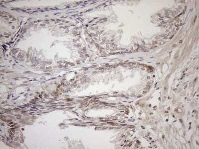 Immunohistochemistry: AAAS Antibody (OTI5B10) [NBP2-45540]