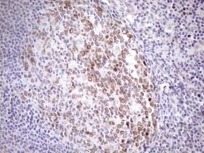 Immunohistochemistry: AAAS Antibody (OTI5B10) [NBP2-45540]