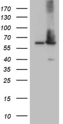 Western Blot: AAAS Antibody (OTI5B10) [NBP2-45540]