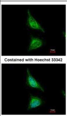 Immunocytochemistry/ Immunofluorescence: AAAS Antibody [NBP2-21596]