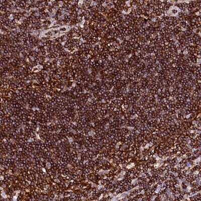 Immunohistochemistry-Paraffin: AAAS Antibody [NBP1-89424]