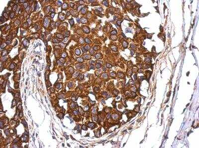 Immunohistochemistry-Paraffin: AAAS Antibody [NBP2-21596]