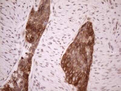 Immunohistochemistry: AAAS Antibody (OTI5B10) - Azide and BSA Free [NBP2-71358]