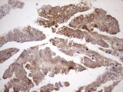 Immunohistochemistry: AAAS Antibody (OTI5B10) - Azide and BSA Free [NBP2-71358]