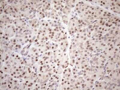 Immunohistochemistry: AAAS Antibody (OTI5B10) - Azide and BSA Free [NBP2-71358]