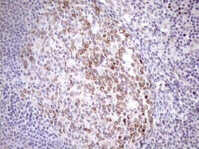 Immunohistochemistry: AAAS Antibody (OTI5B10) - Azide and BSA Free [NBP2-71358]