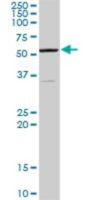 Western Blot: AAAS Antibody [H00008086-D01P]