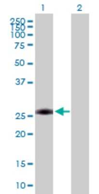 Western Blot: AAAS Antibody [H00008086-D01P]