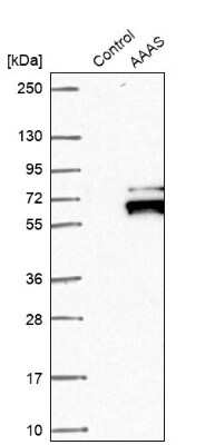 Western Blot: AAAS Antibody [NBP1-89424]