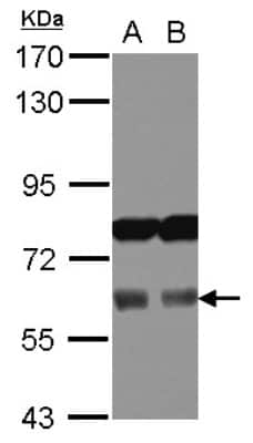 Western Blot: AAAS Antibody [NBP2-21596]