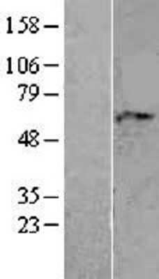 Western Blot: AAAS Overexpression Lysate [NBL1-07159]