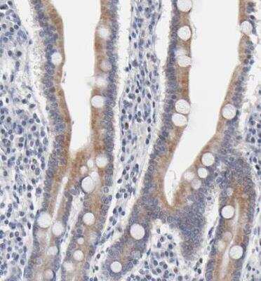 Immunohistochemistry-Paraffin: AADAC Antibody [NBP1-85680]