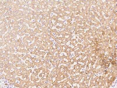 Immunohistochemistry-Paraffin: AADAC Antibody [NBP2-99385]